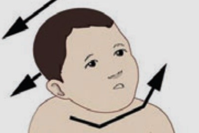 사경클리닉 관련 이미지