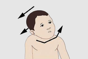 사경클리닉 치료 관련 이미지
