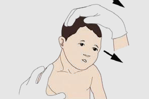 사경클리닉 치료 관련 이미지